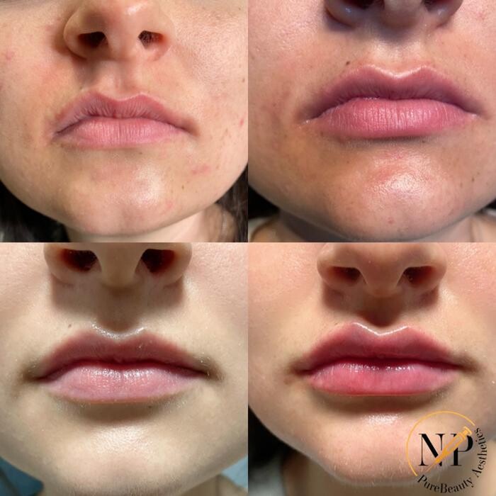 Images PureBeautyNP Aesthetics