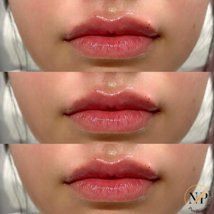 Images PureBeautyNP Aesthetics