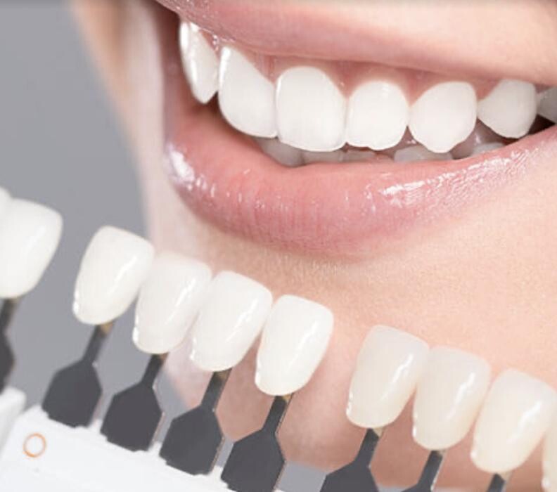 Images Gregory Dental Group