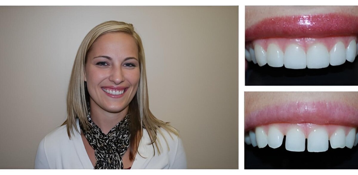 Images Bright Smiles Dental