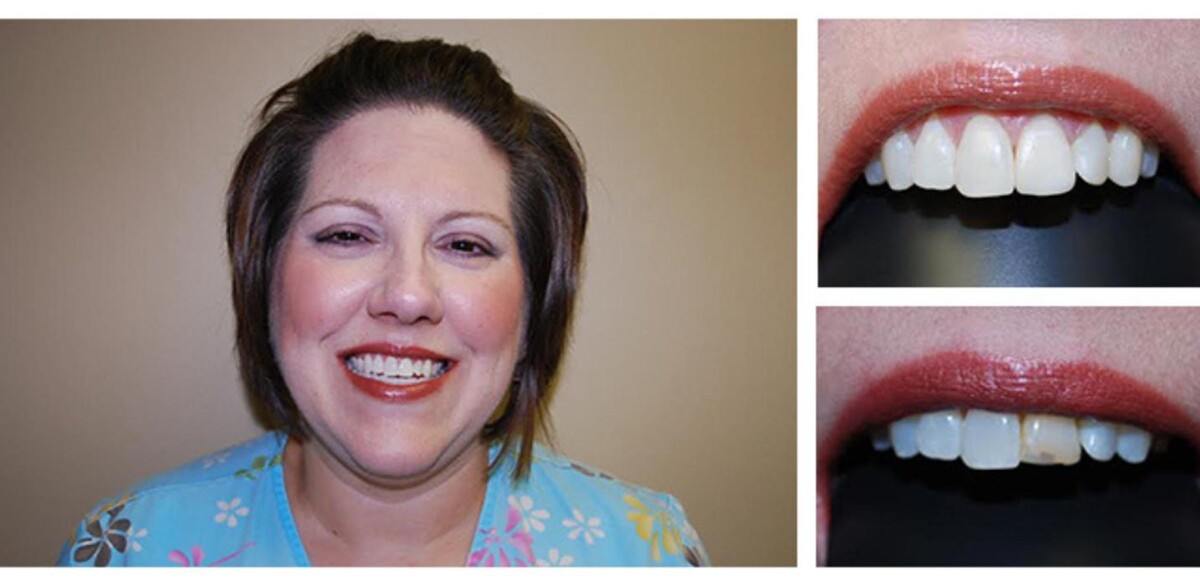 Images Bright Smiles Dental