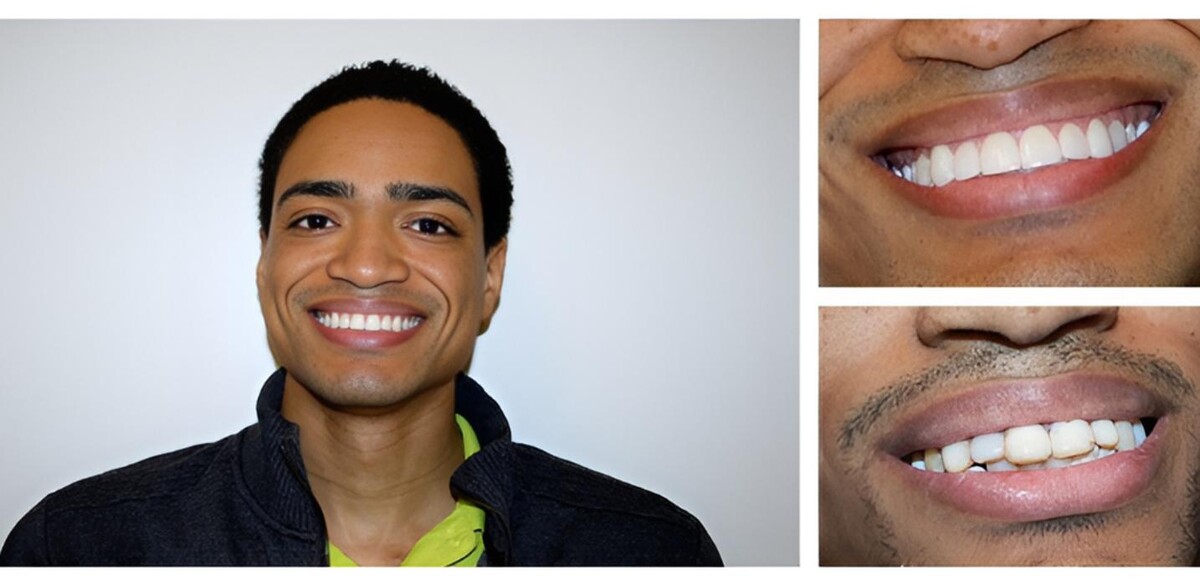 Images Bright Smiles Dental