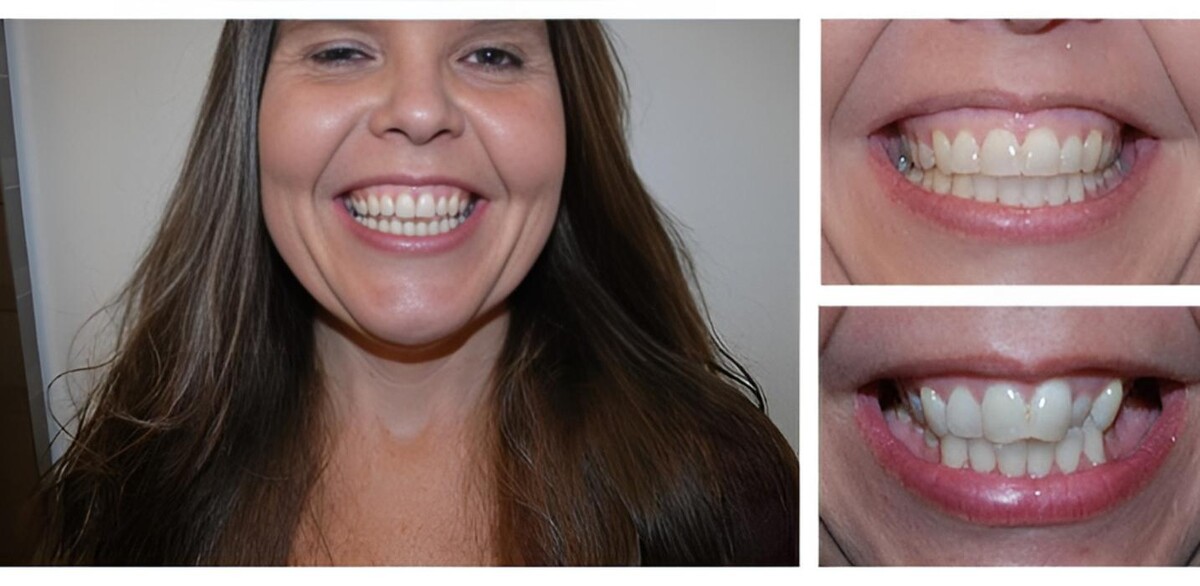 Images Bright Smiles Dental