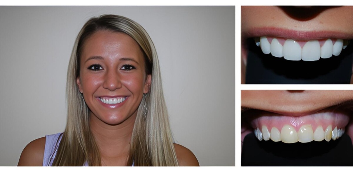 Images Bright Smiles Dental