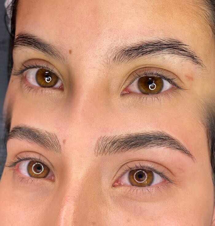 Images TS Browshes Esthetics and Laser