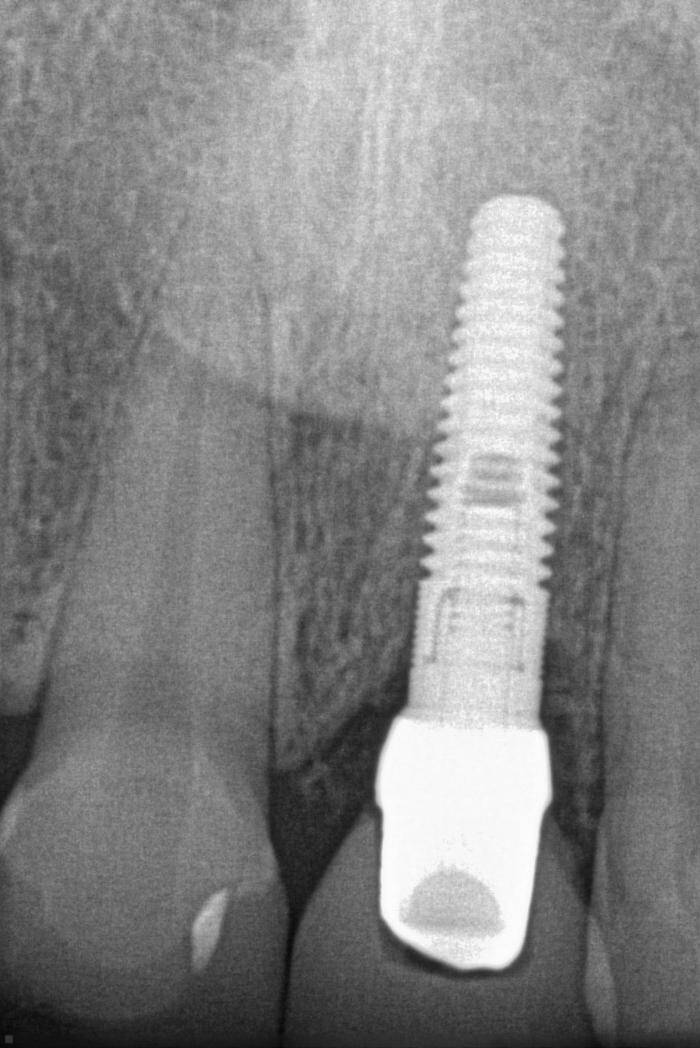 Images Draper Dental