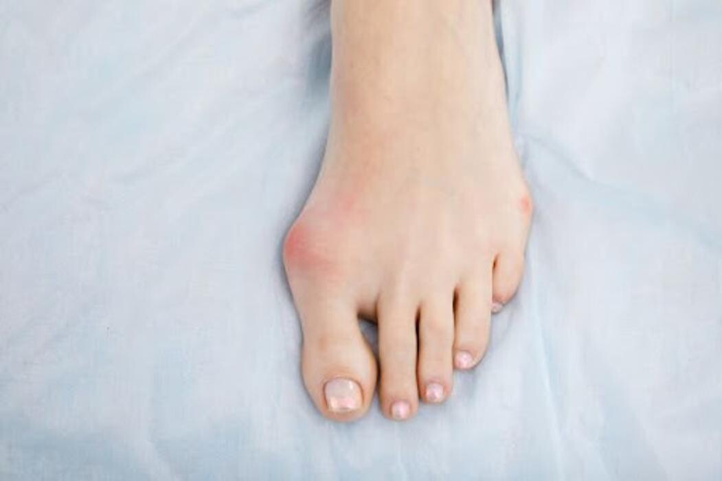 Images The Foot Institute