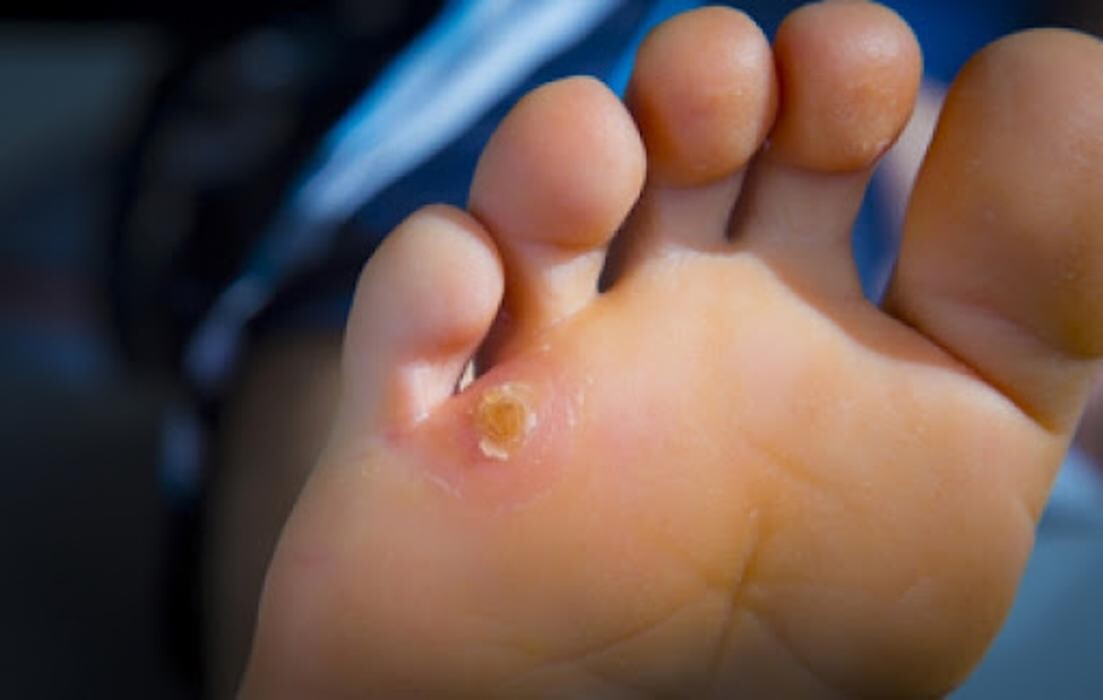 Images The Foot Institute