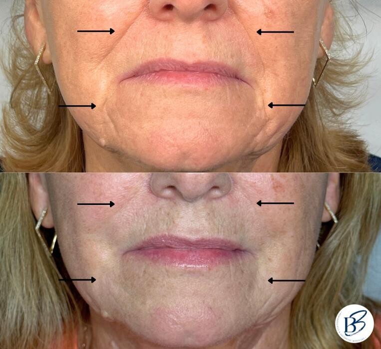 Images B3 Performance and Aesthetic Medicine