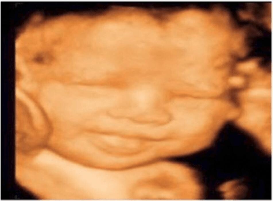 Images Beli's 5D & Belly Cast