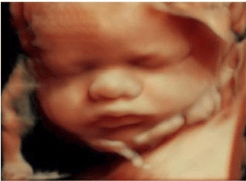 Images Beli's 5D & Belly Cast