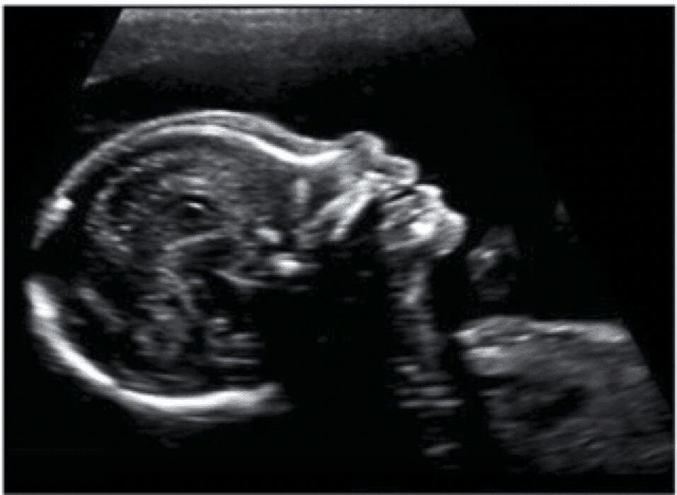 Images Beli's 5D & Belly Cast