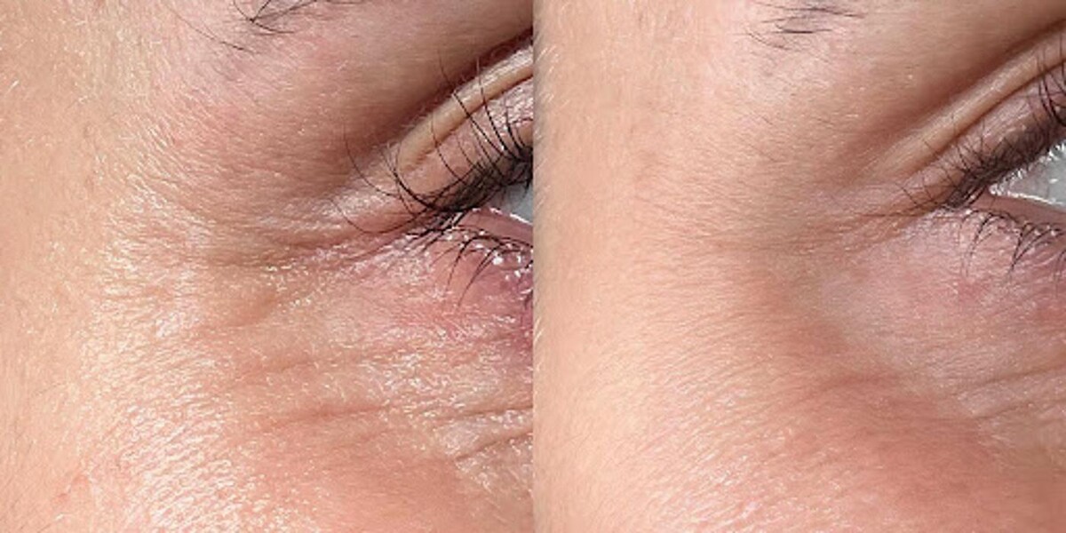 Images Sanavital Med Spa