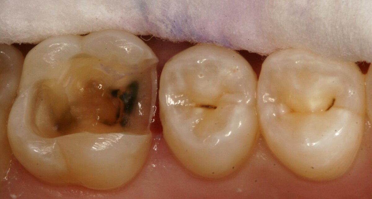 Images TERAN Dental Co.