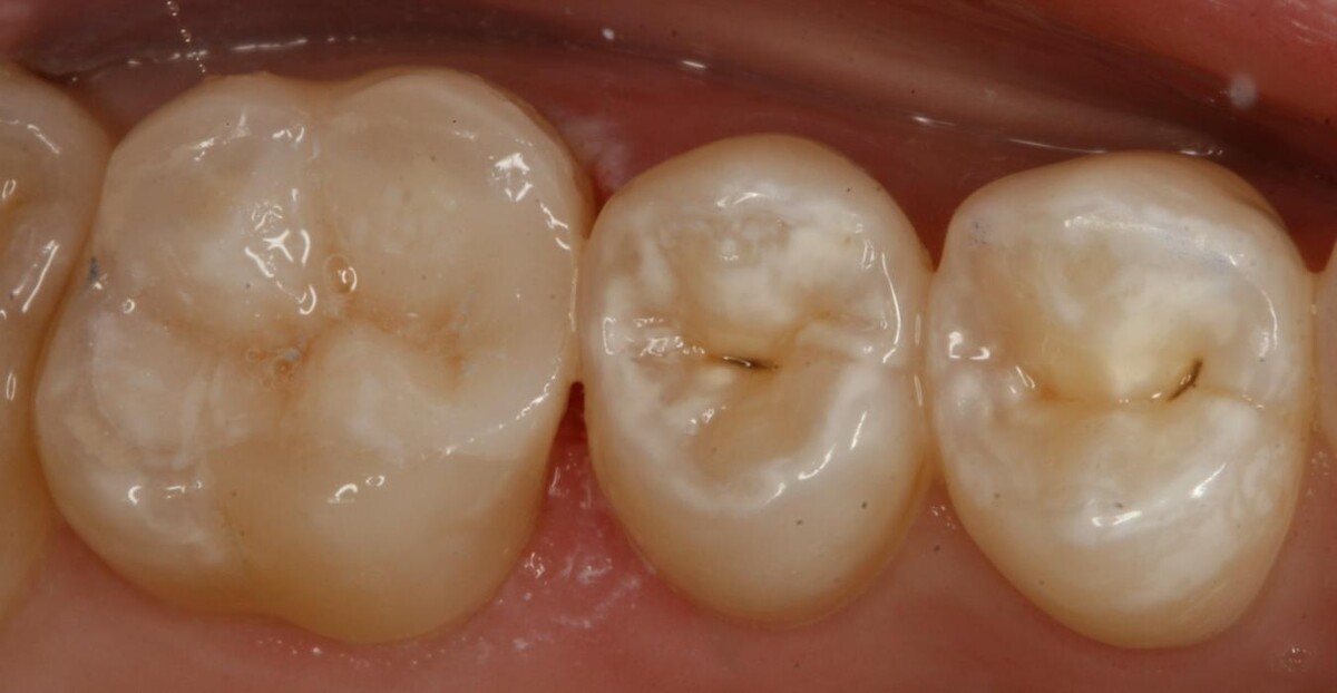 Images TERAN Dental Co.