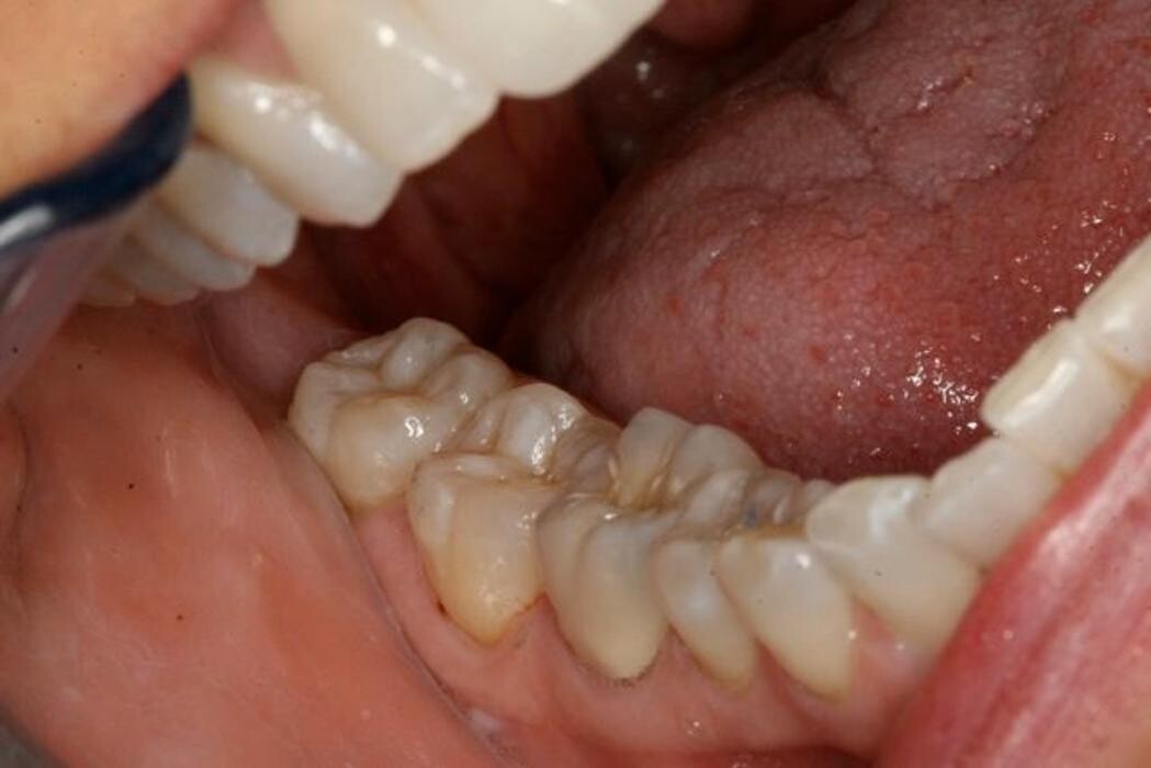Images TERAN Dental Co.