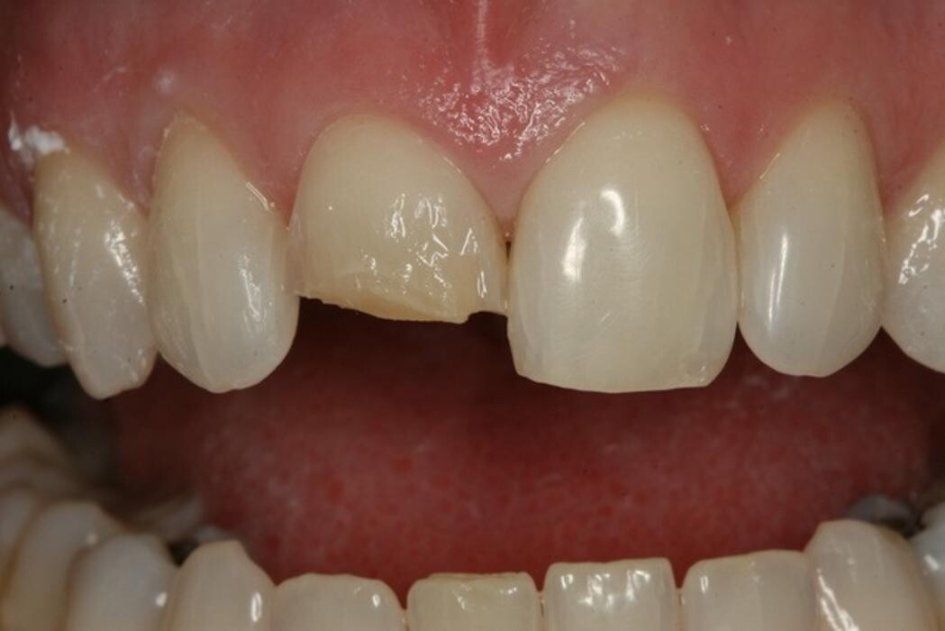 Images TERAN Dental Co.