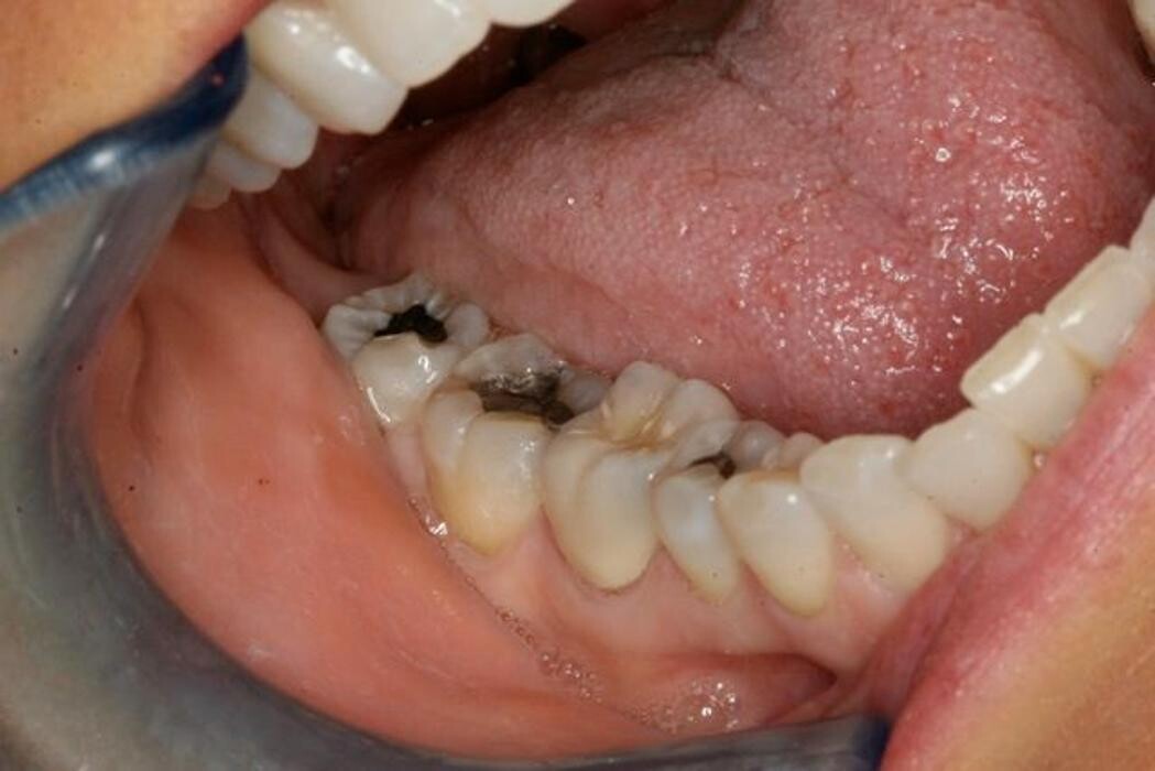 Images TERAN Dental Co.