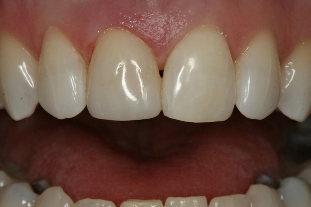 Images TERAN Dental Co.