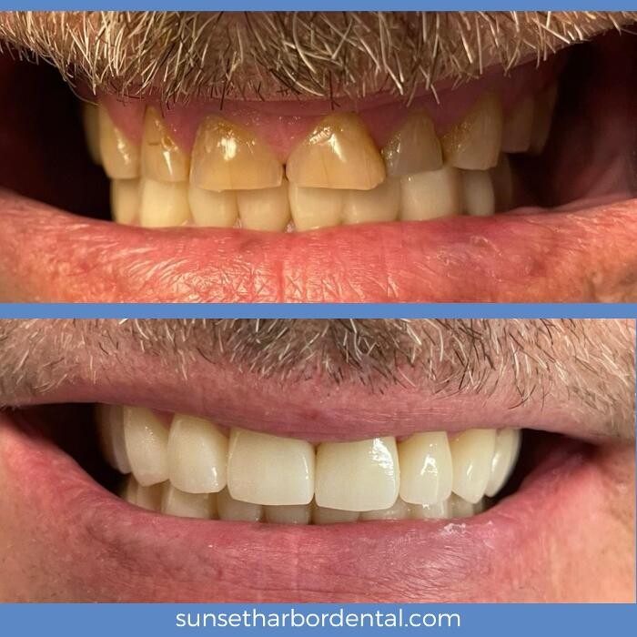 Images Sunset Harbor Dental