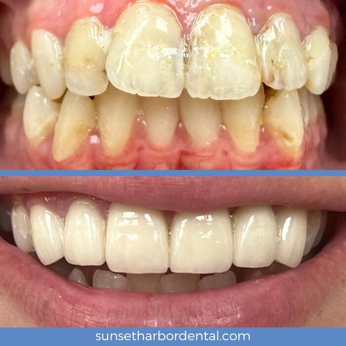 Images Sunset Harbor Dental