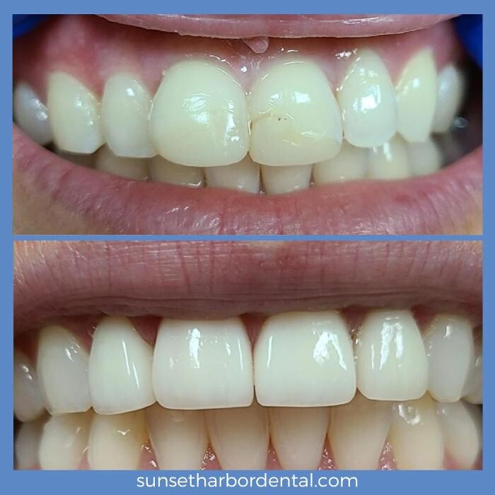 Images Sunset Harbor Dental