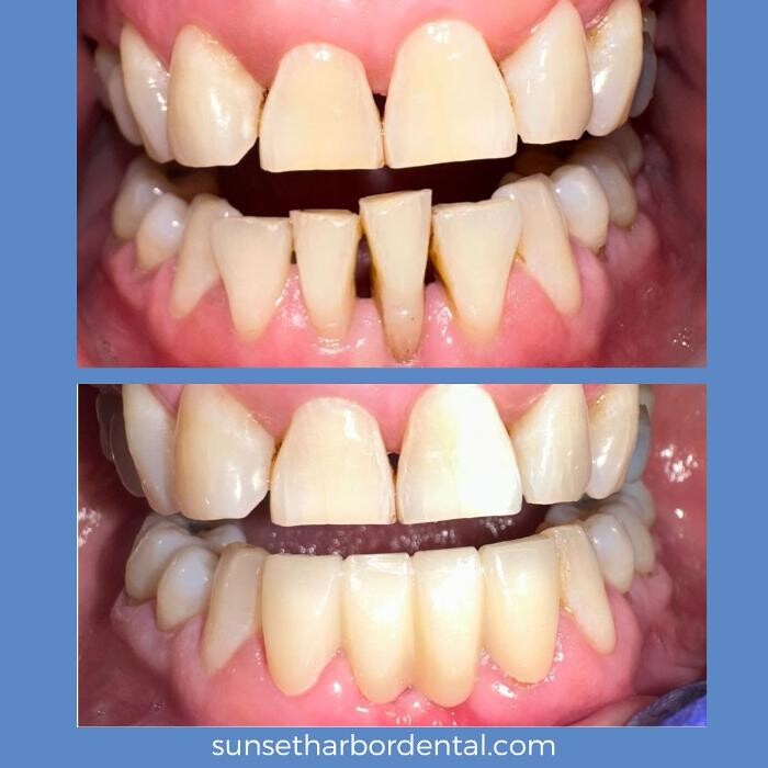 Images Sunset Harbor Dental