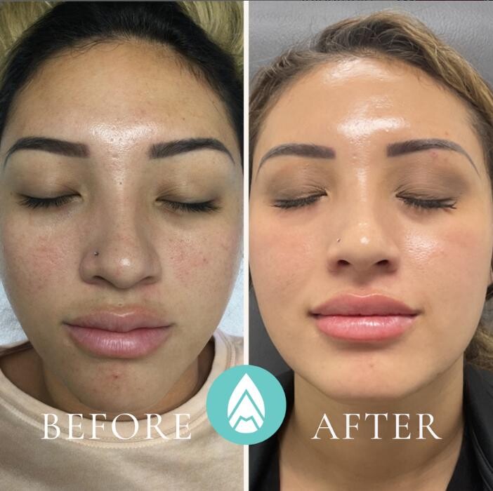 Images Almond Aesthetic Medicine