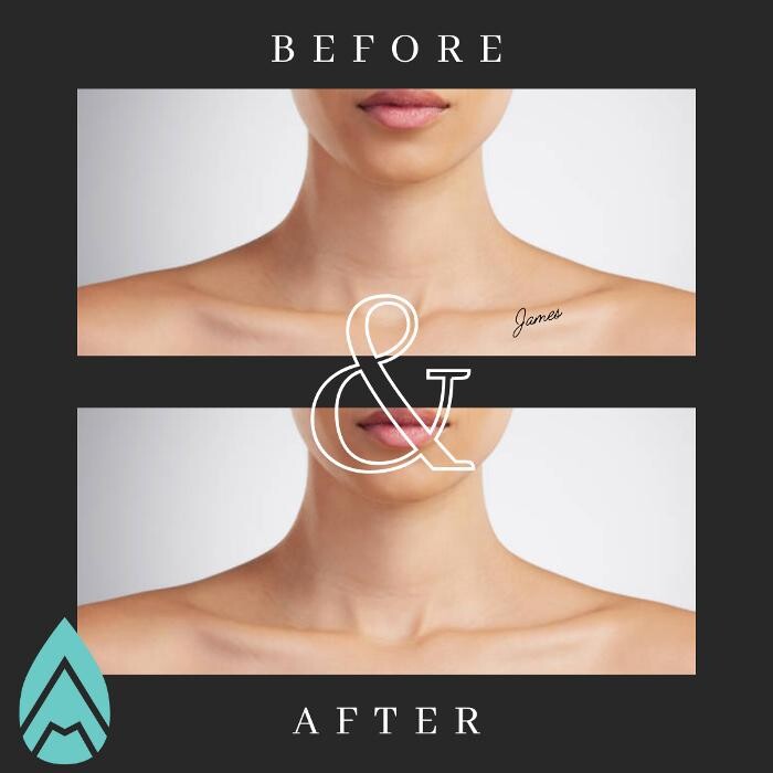 Images Almond Aesthetic Medicine