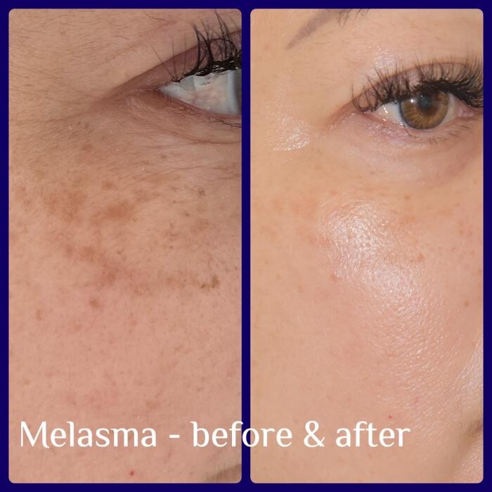 Images Medical Laser & Aesthetics