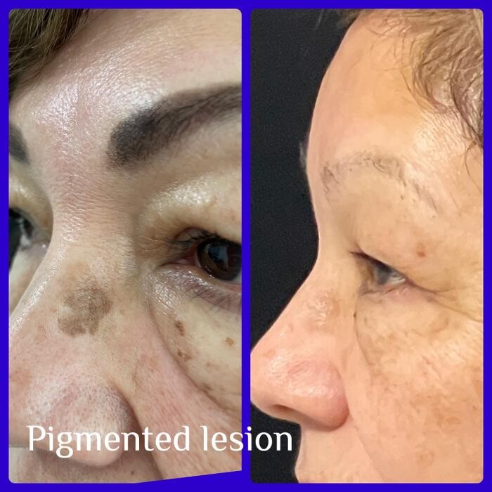 Images Medical Laser & Aesthetics