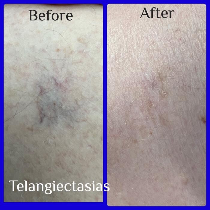 Images Medical Laser & Aesthetics