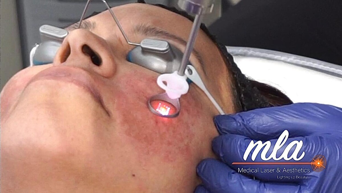 Images Medical Laser & Aesthetics