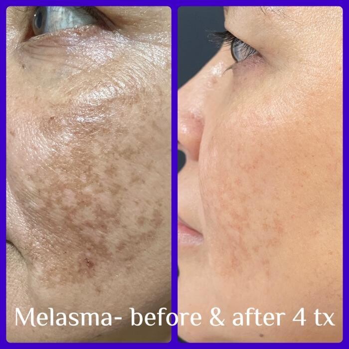 Images Medical Laser & Aesthetics