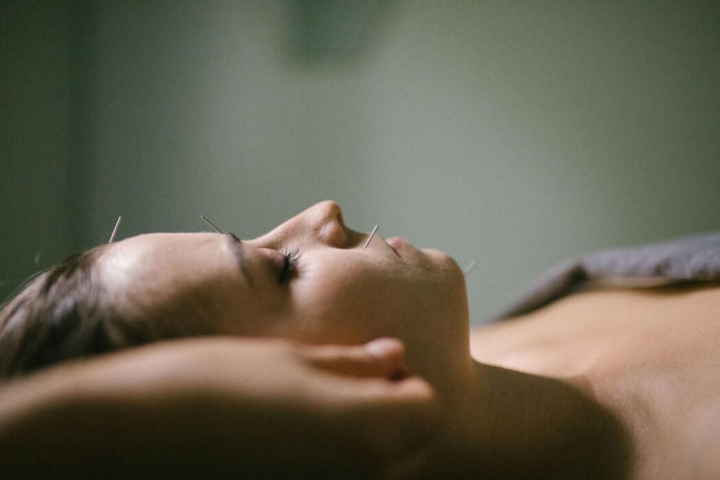 Images Zoi Well Acupuncture & Herbal Medicine