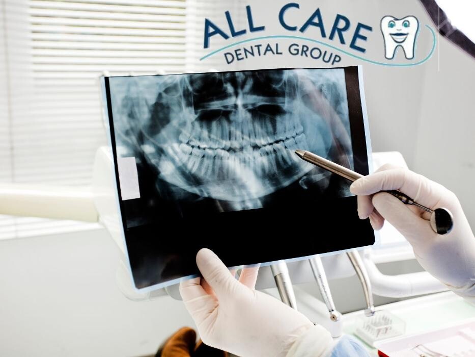 Images All Care Dental Group: Ehab Ateia DDS