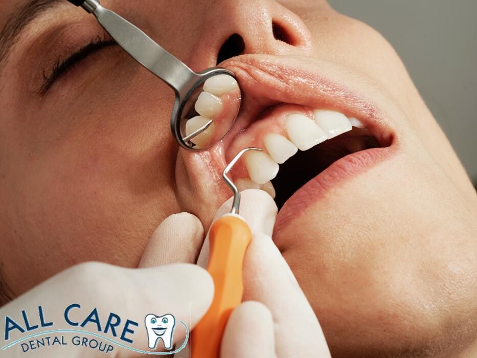 Images All Care Dental Group: Ehab Ateia DDS