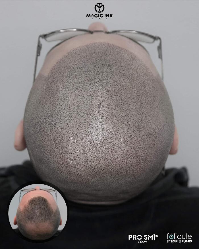 Images Magic Ink SMP