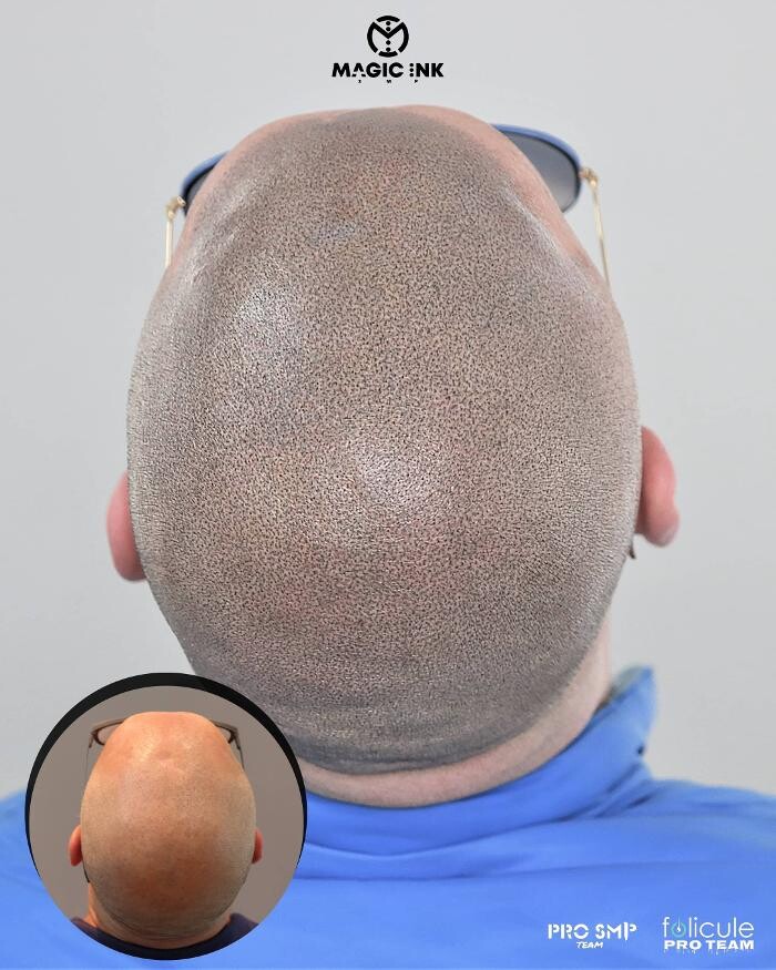 Images Magic Ink SMP