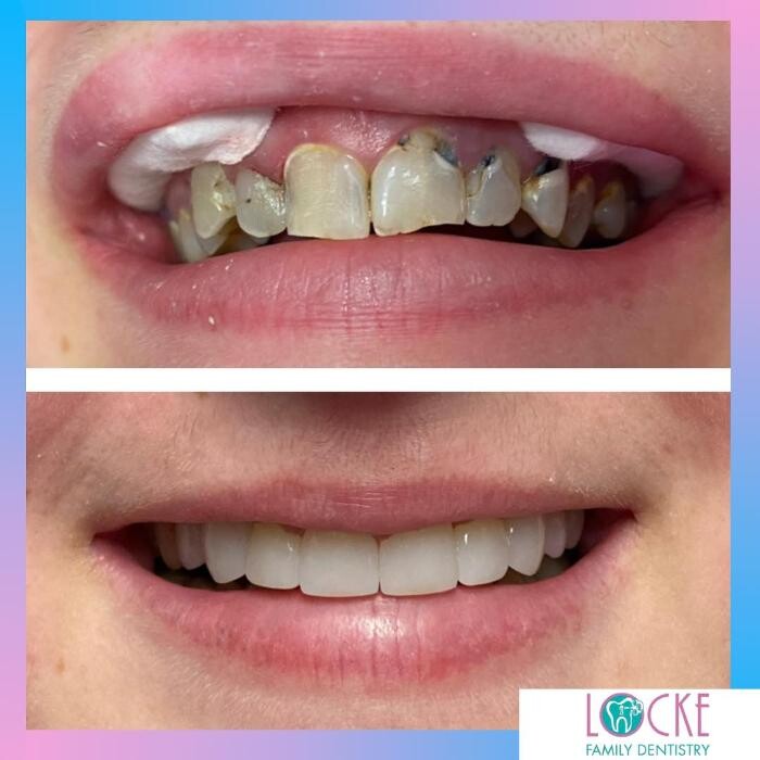 Images Locke Family Dentistry