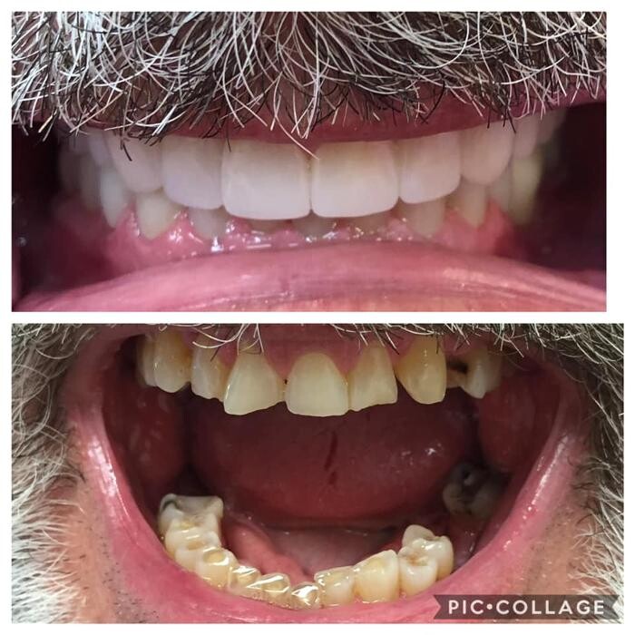 Images Locke Family Dentistry