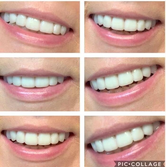 Images Locke Family Dentistry