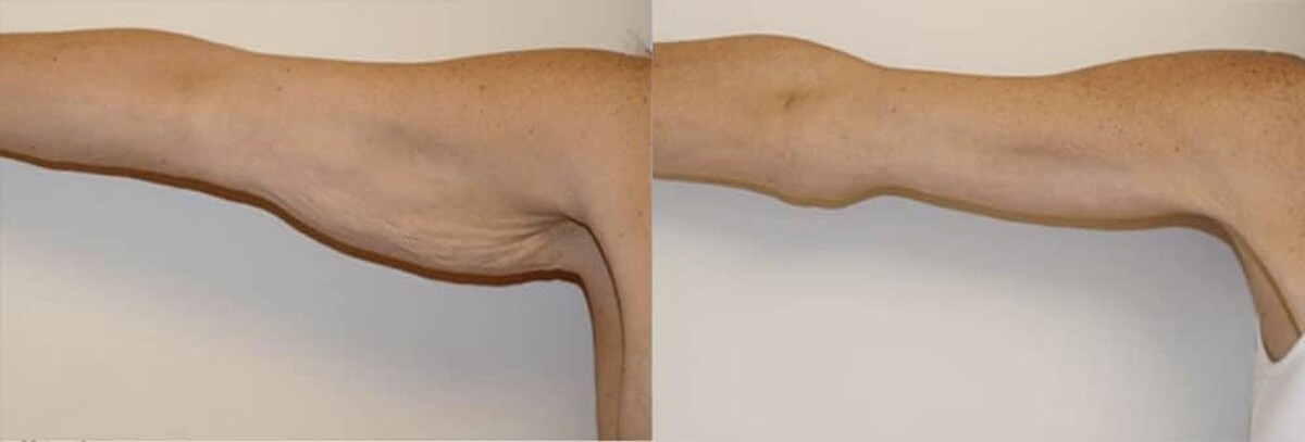 Images Feldmar Aesthetics | Dr. David Feldmar
