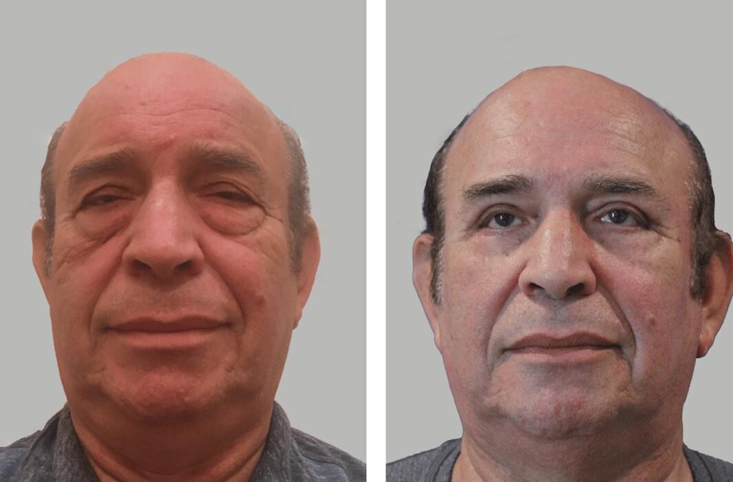 Images Feldmar Aesthetics | Dr. David Feldmar