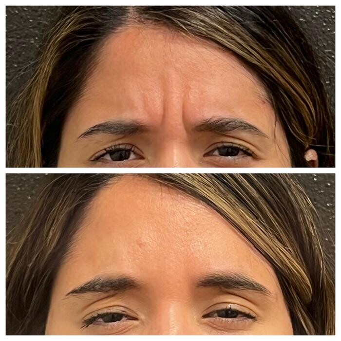 Images Truly Lifted MedSpa
