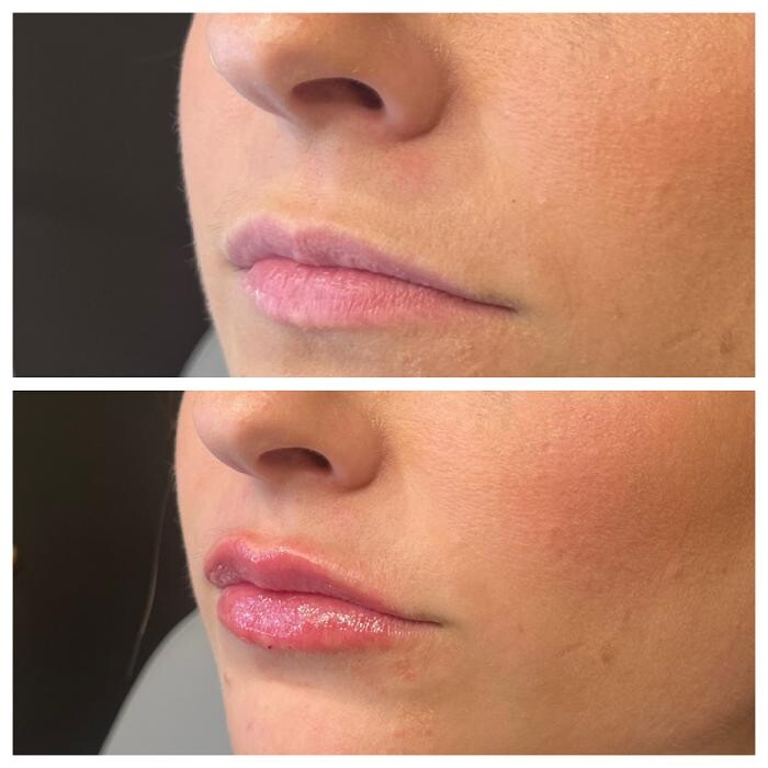 Images Truly Lifted MedSpa