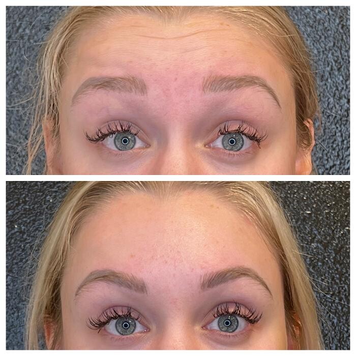 Images Truly Lifted MedSpa