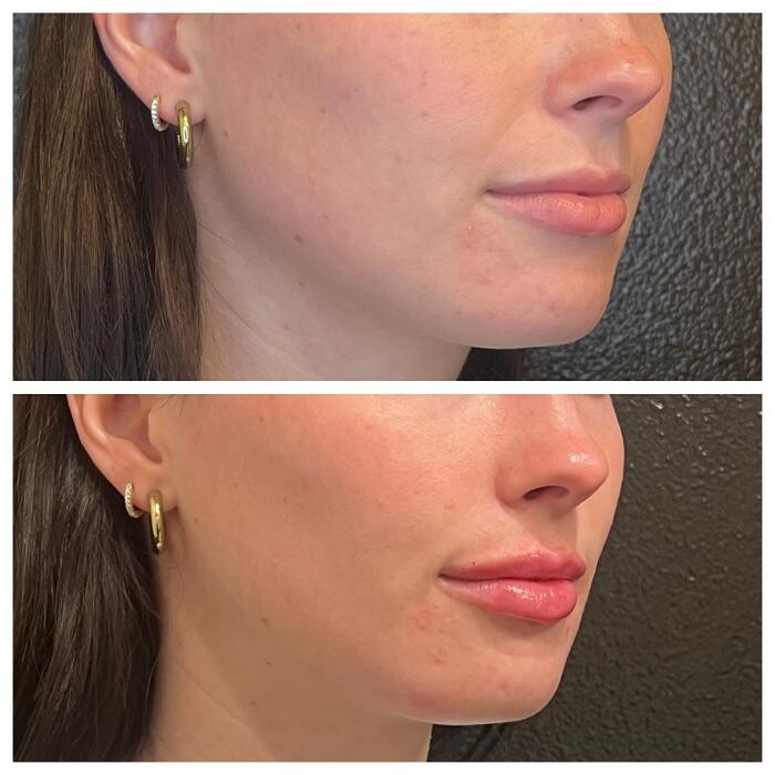 Images Truly Lifted MedSpa