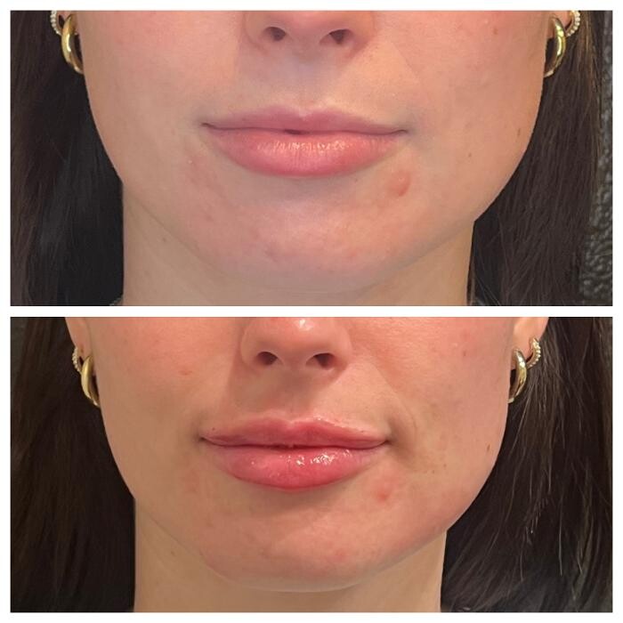 Images Truly Lifted MedSpa