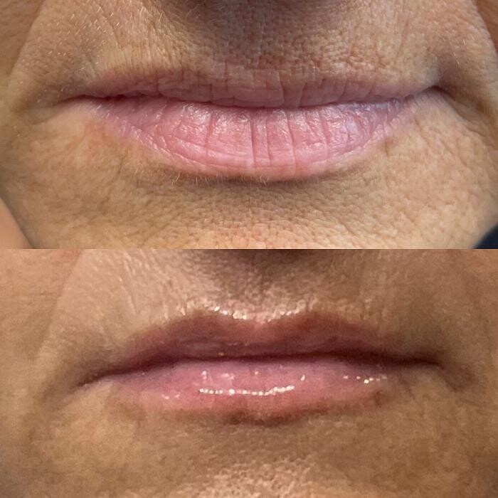 Images More than Lip Service